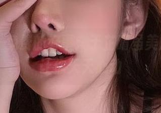 微密圈 – 免费的好事：于芷晴虽美腿图册，让你天天心动